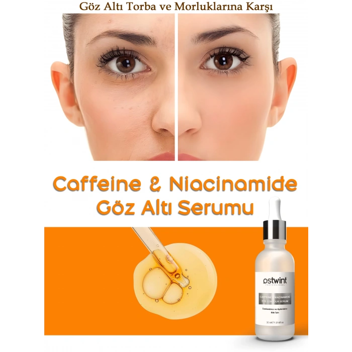 Ostwint Caffeine Niacinamide Aydınlatıcı Sıkılaştırıcı Göz Altı, Çevresi Morluk Torba Karşıtı Serumu