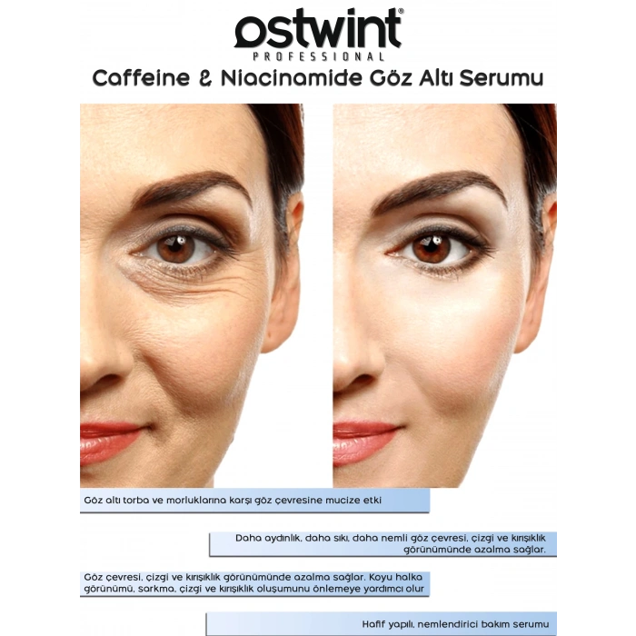 Ostwint Caffeine Niacinamide Aydınlatıcı Sıkılaştırıcı Göz Altı, Çevresi Morluk Torba Karşıtı Serumu
