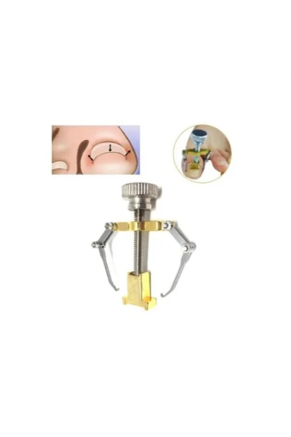 Batık Tırnak Çıkartıcı Aparat