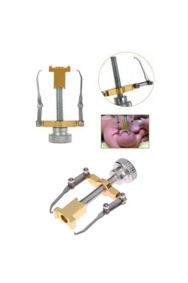 Batık Tırnak Düzeltme Aleti