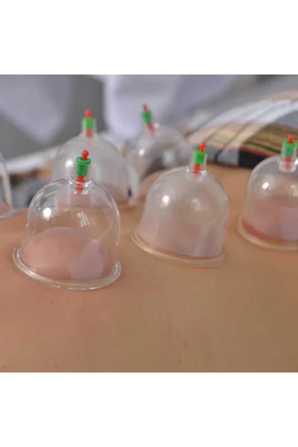 Hacamat Kupa Seti 6 Adet