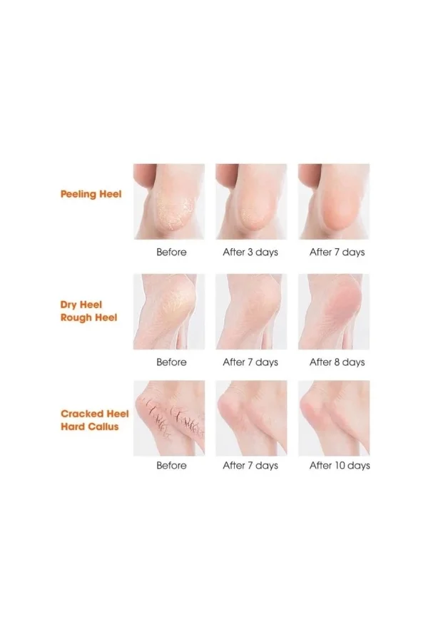 Silikon Topuk Nemlendirici Çorap