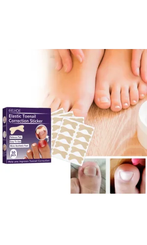 Ayak Tırnağı Düzeltme Bandı 50 Adet