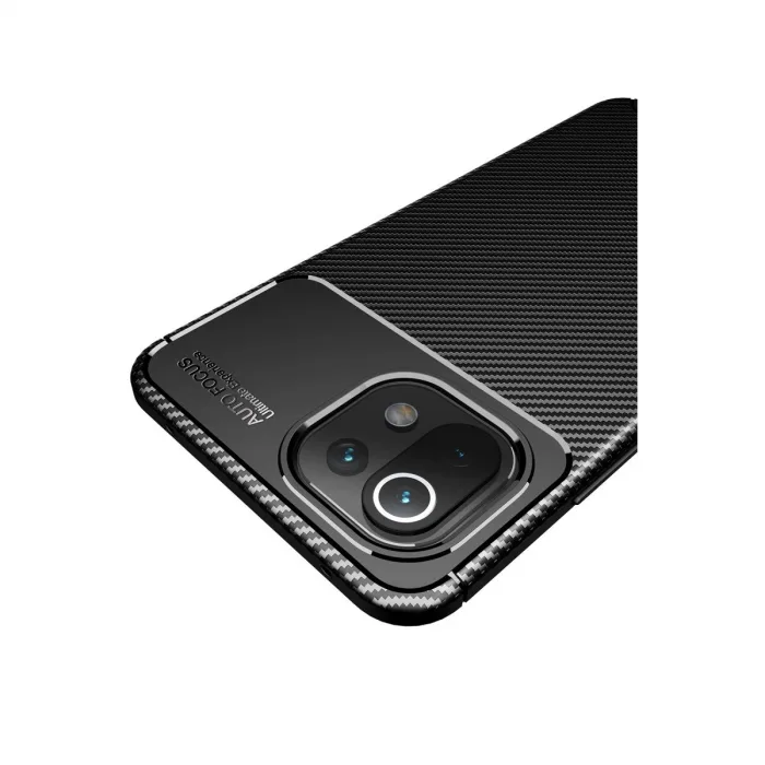 Xiaomi Mi 11 Lite Kılıf Auto Focus Karbon Kapak - Siyah