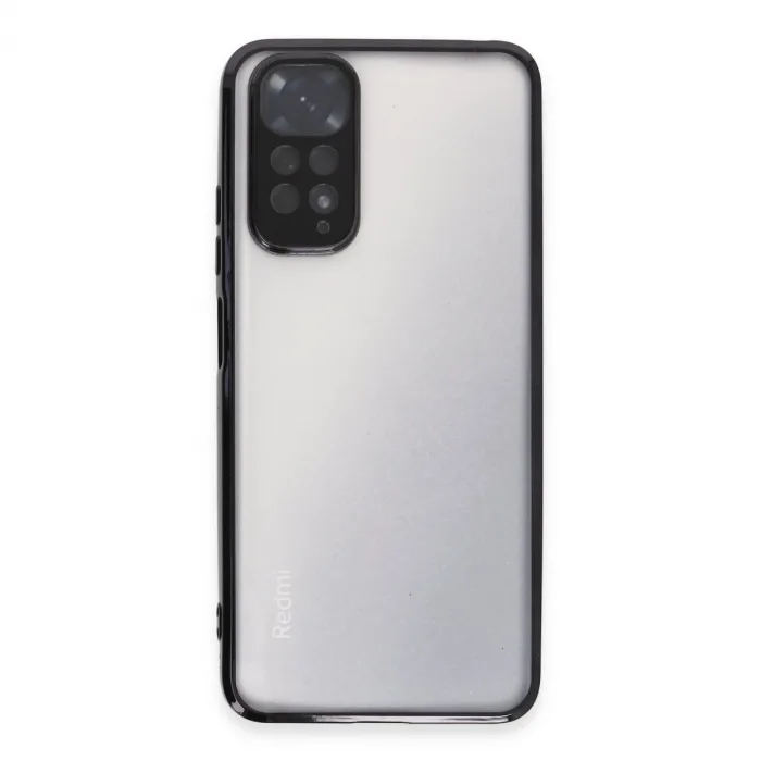 Xiaomi Redmi Note 11 Kılıf Razer Lensli Silikon - Siyah