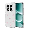 Xiaomi Redmi Note 15 Pro Plus 5g Fiyonk Desenli Kapak - Desen 3