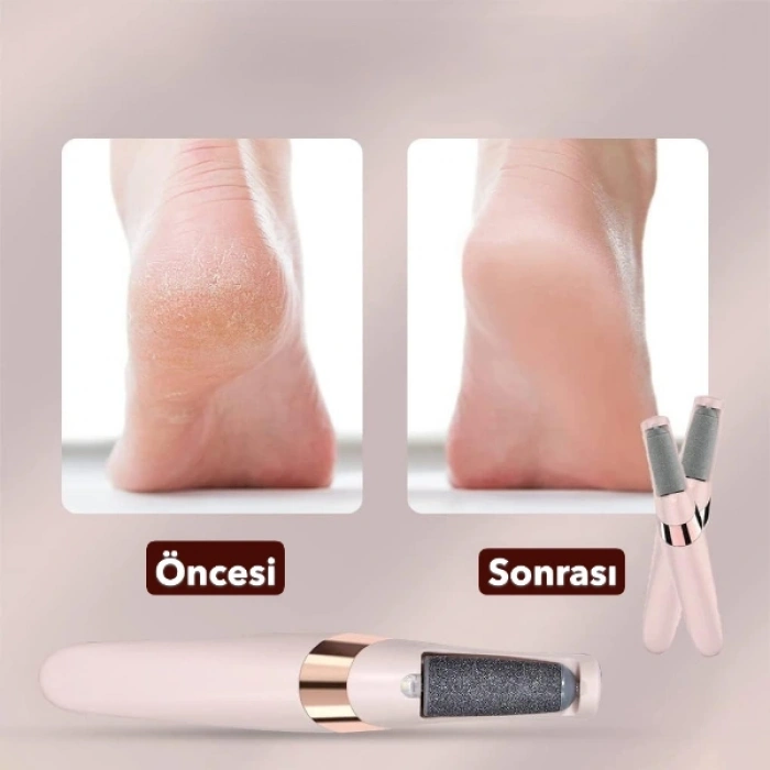 Şarjlı Ayak Törpüsü - Pedikür ve Ayak Bakım Aleti