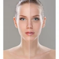 143 Purlés VitC Serum Perfector Cilt Tonu Eşitleyici C Vitamini Serum 30 ml