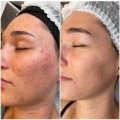 Purlés Baby Face Set