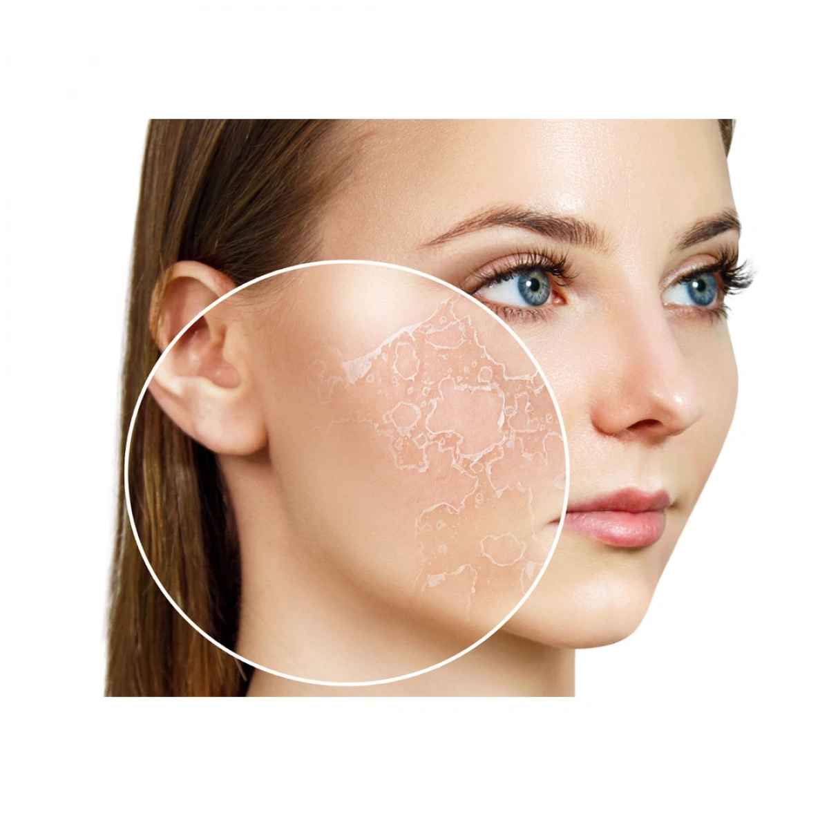 162 Purlés Mini Microbiome Protection Atopik ve Hassas Ciltler için Yatıştırıcı Krem 15 ml