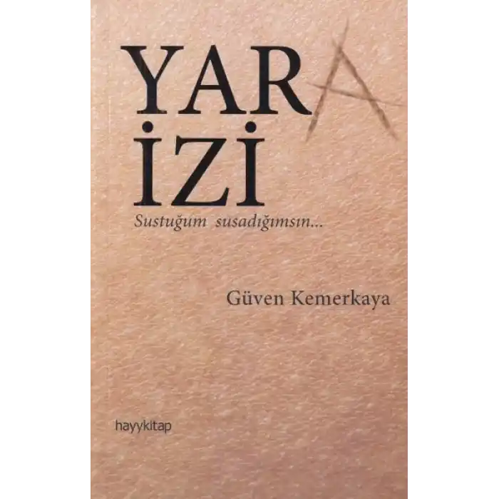 Yara İzi