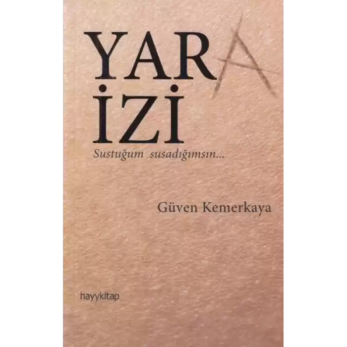 Yara İzi