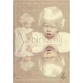 Albinizmli Bir Çocuk Yetiştirmek
