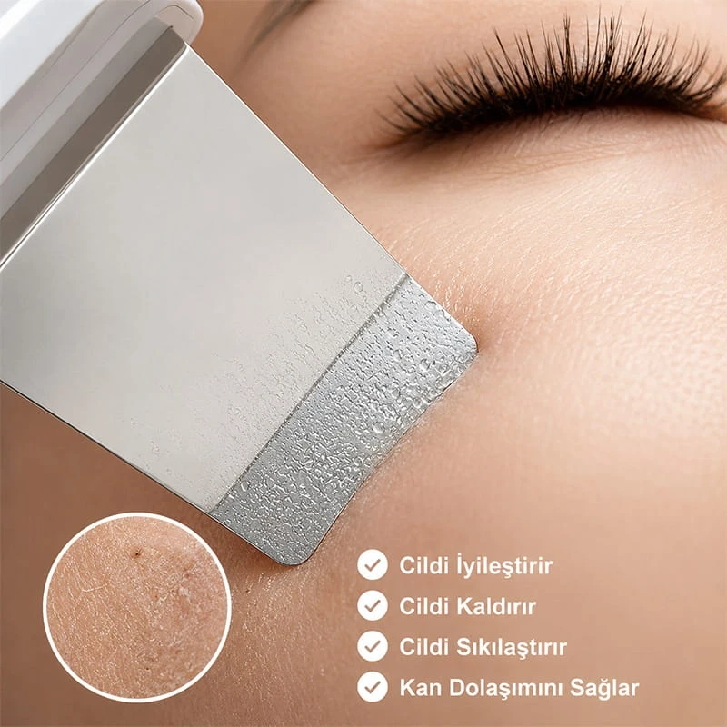Ultrasonic Spatula Yüz Siyah Nokta Temizleme Cihazı Şarjlı Cilt Temizleyici