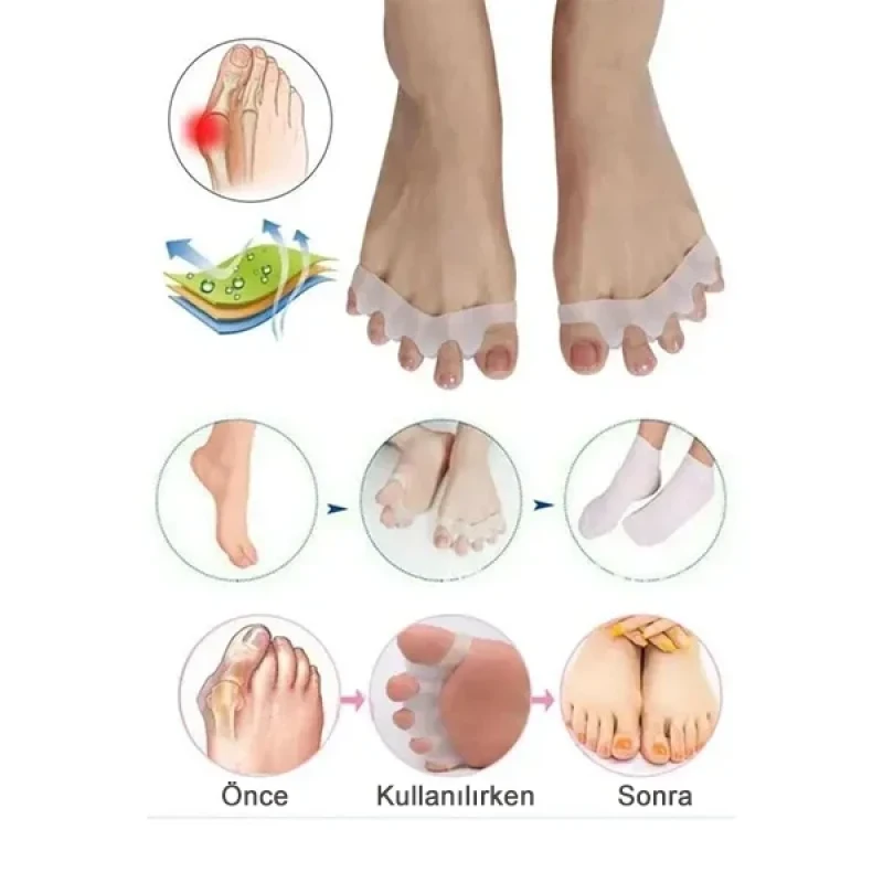 Ayak 5 Parmak Ayıran Geçmeli Silikon Bunyon