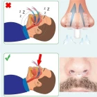 Horlama Önleyici Burun Aparatı