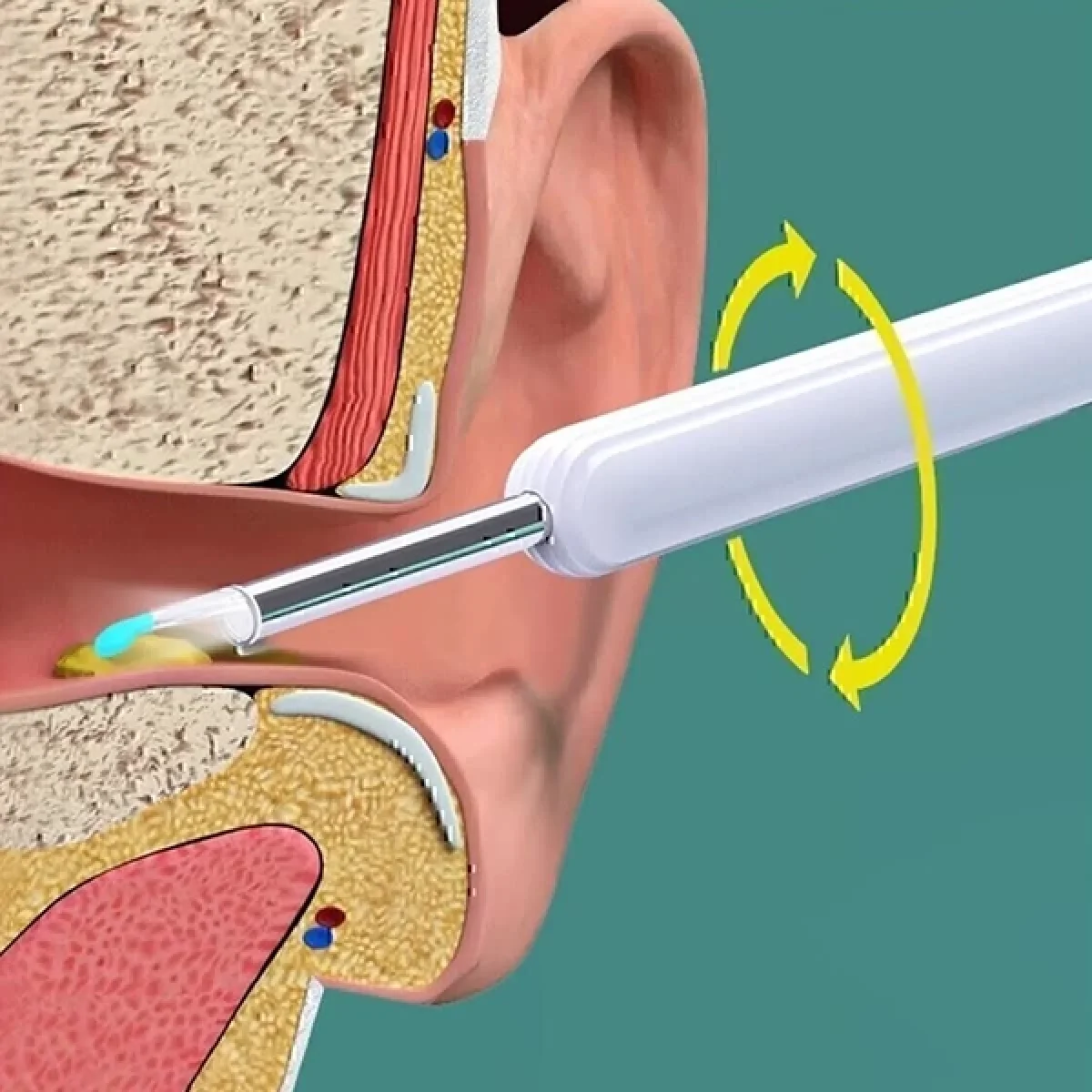 Kameralı Led Işıklı Kablosuz Kulak Temizleme Cihazı