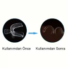 Diş Gıcırdatma Diş Sıkma Çene Sıkma Önleyici Silikon Gece Plağı