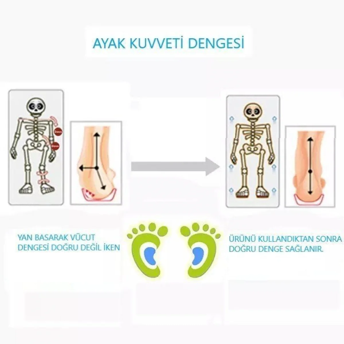 Düz Taban Ağrı Giderici Tabanlık
