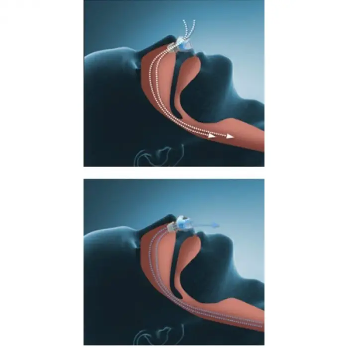 Horlama Önleyici Rahat Uyku Aparatı