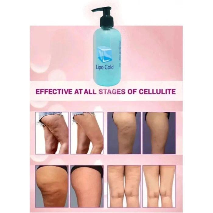 Hubrendy Bez Süper Lipo Cold  G.çlü  Krem 250 ml x 2 Adet