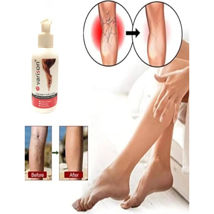 Hubrendy Bez Süper Varison Bacak Bakım Kremi 120 ml