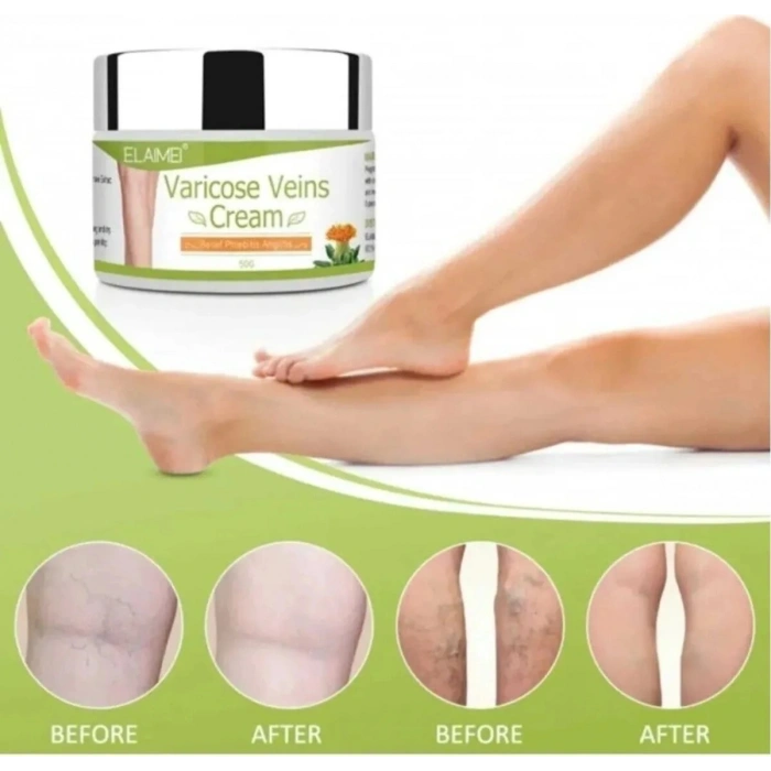 Hubrendy Bez Varicose Kremi 100 ml