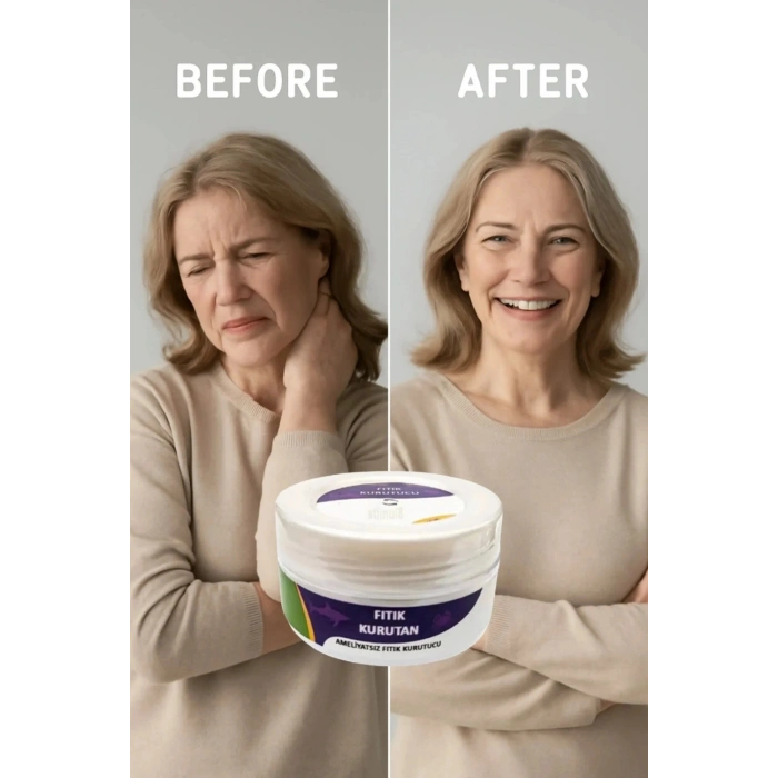 Hubrendy Bez Fıtık Kurutan Krem 50 ml