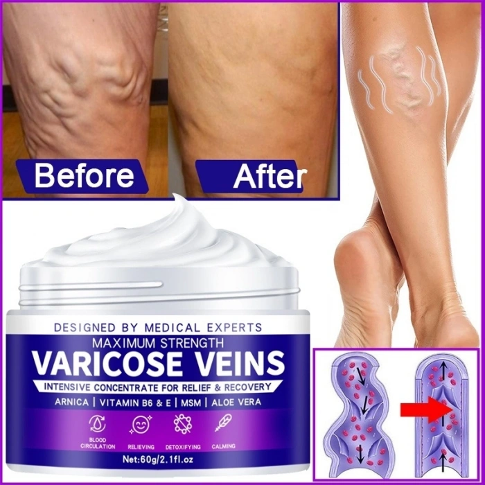 Hubrendy Bez Maximum Strength Varicose Veins Krem 100 ml 1 Adt