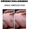 Hubrendy Bez Varicose Kremi 100 ml