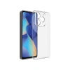 Hubrendy Bez General Mobile Era 30 Kılıf Lüx Şeffaf Silikon