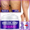 Hubrendy Bez Maximum Strength Varicose Veins Krem 100 ml 1 Adt