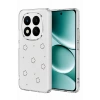 Hubrendy Bez Xiaomi Redmi Note 15 Pro Plus 5G Fiyonk Desenli Kapak - Desen 2