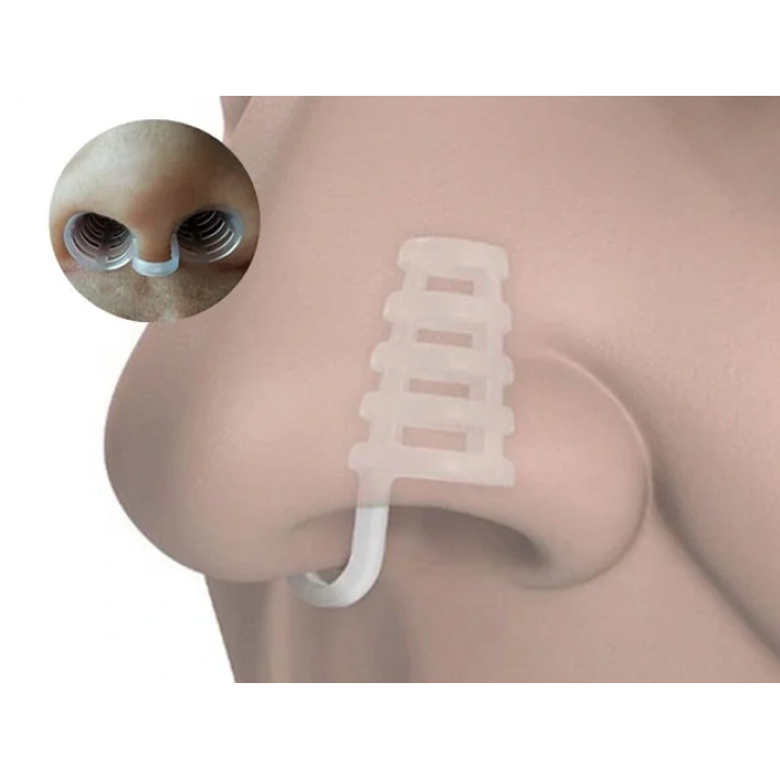 USLUCAN ALIŞVERİŞ Horlama Burun Aparatı - Kafesli