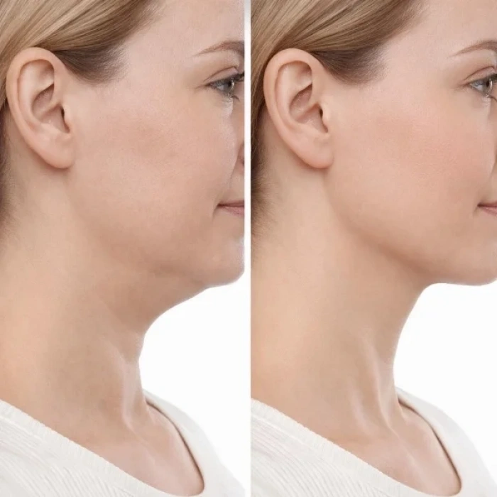 USLUCAN ALIŞVERİŞ Lenfatik Drenaj Masaj Fırçası