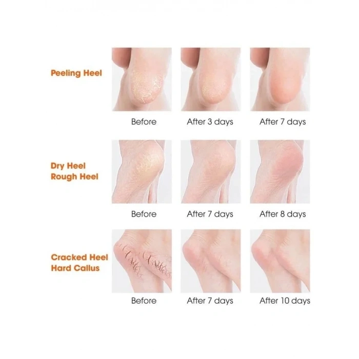 USLUCAN ALIŞVERİŞ Silikon Topuk Nemlendirici Çorap