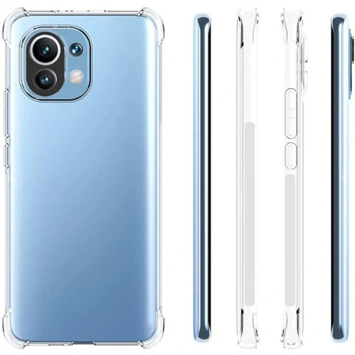 Xiaomi Mi 11 Lite Kamera Korumalı Shockproof Şeffaf Silikon Kılıf-(5775)