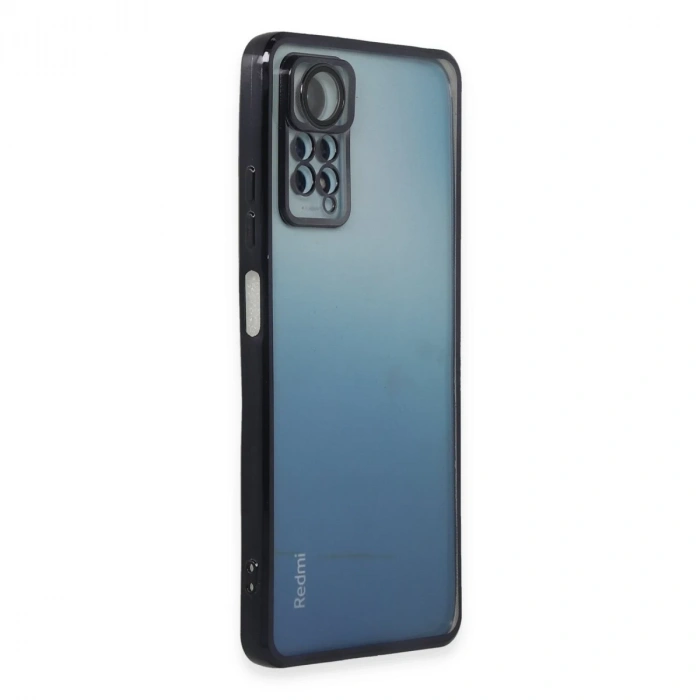Xiaomi Redmi Note 11 Pro Kılıf Razer Lensli Silikon - Siyah