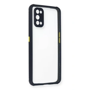USLUCAN ALIŞVERİŞ Realme 7 Pro Kılıf Miami Şeffaf Silikon - Lacivert
