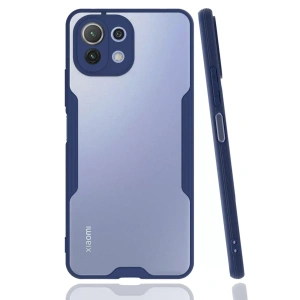 USLUCAN ALIŞVERİŞ Xiaomi Mİ 11 Lite Kılıf Platin Silikon - Lacivert