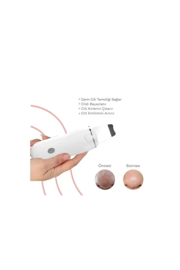 Ultrasonik Spatula Yüz Akne Giderici Siyah Nokta Temizleme Cihazı