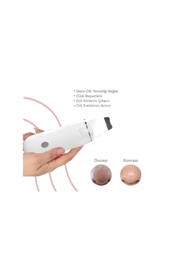 Ultrasonik Spatula Yüz Akne Giderici Siyah Nokta Temizleme Cihazı