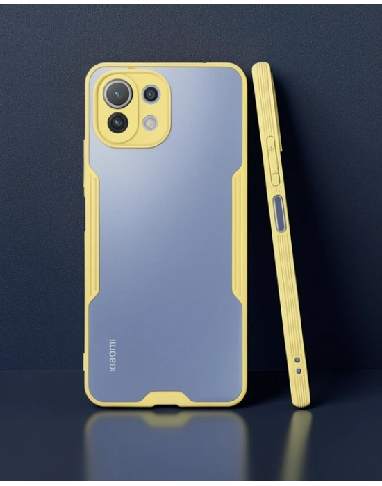 Xiaomi Mi 11 Lite Kılıf Platin Silikon - Sarı