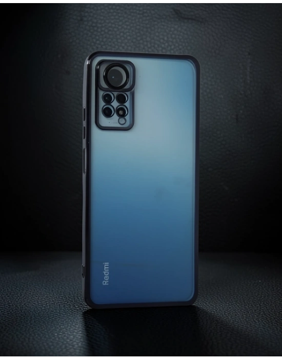Xiaomi Redmi Note 11 Pro Kılıf Razer Lensli Silikon - Siyah