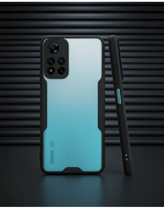 Xiaomi Redmi Note 11 Pro Plus 5g Kılıf Platin Silikon - Siyah