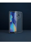 General Mobile Era 50 Kılıf Lüx Şeffaf Silikon