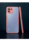 Xiaomi Mi 11 Lite Kılıf Platin Silikon - Pembe