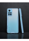 Xiaomi Redmi Note 11t Kılıf Platin Silikon - Mavi