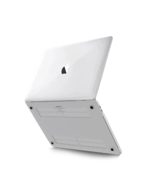 Apple Macbook Pro 13 2020 Macbook Buzlu Kapak - Şeffaf