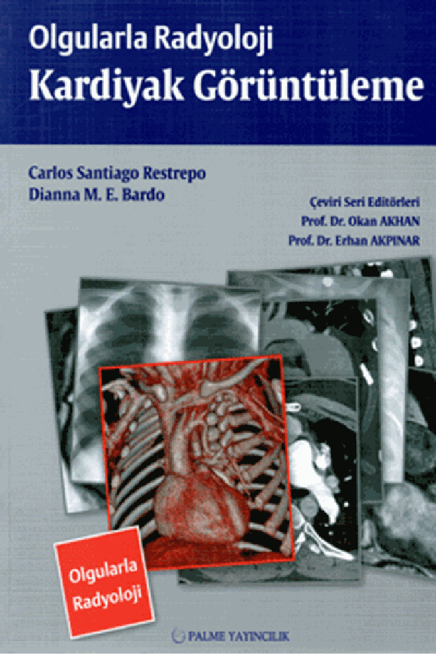 OLGULARLA RADYOLOJİ KARDİYAK GÖRÜNTÜLEME (PALME)